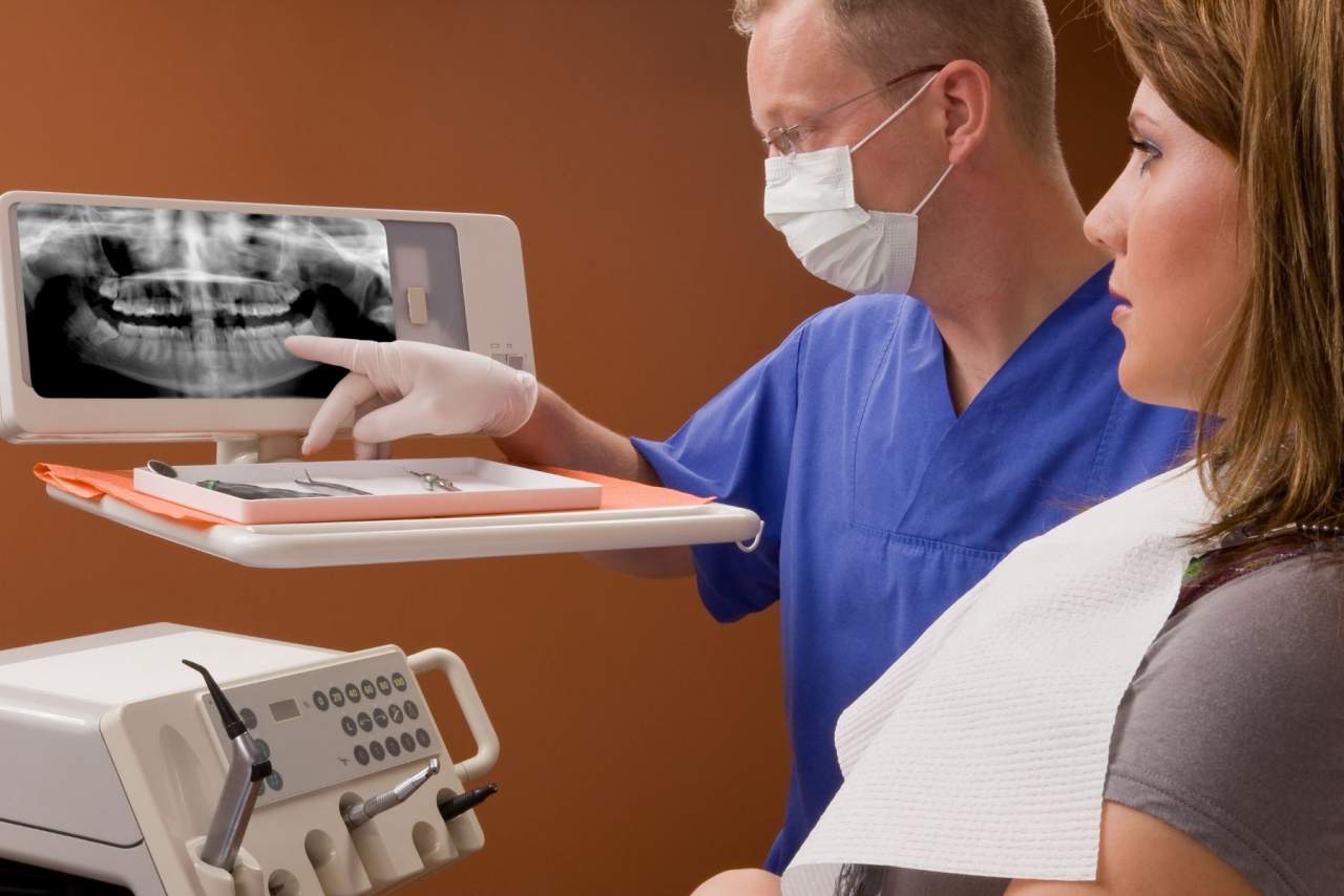 ¿Es posible tener caries con implantes?