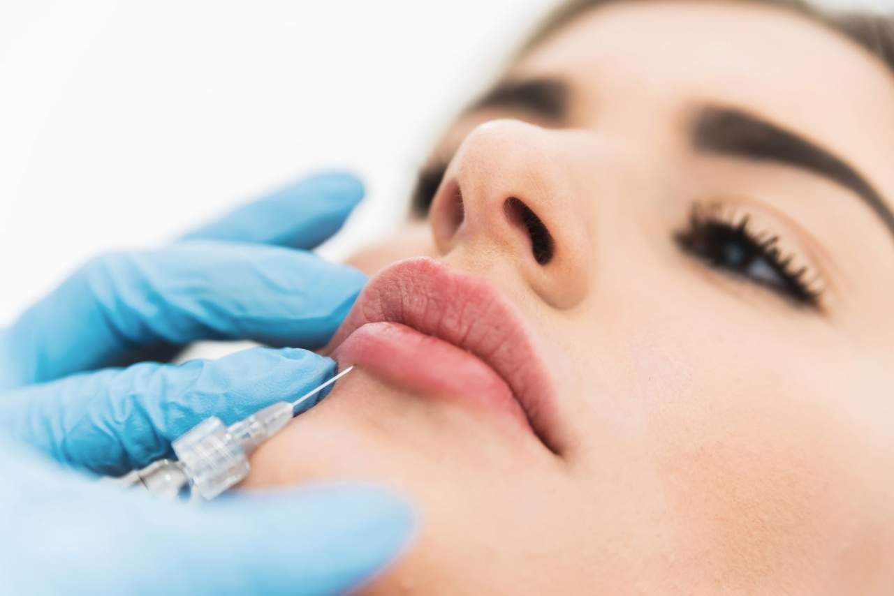 Conoce la Clínica Sánchez Peral, especialista en aumento de labios con ácido hialurónico en Castellón