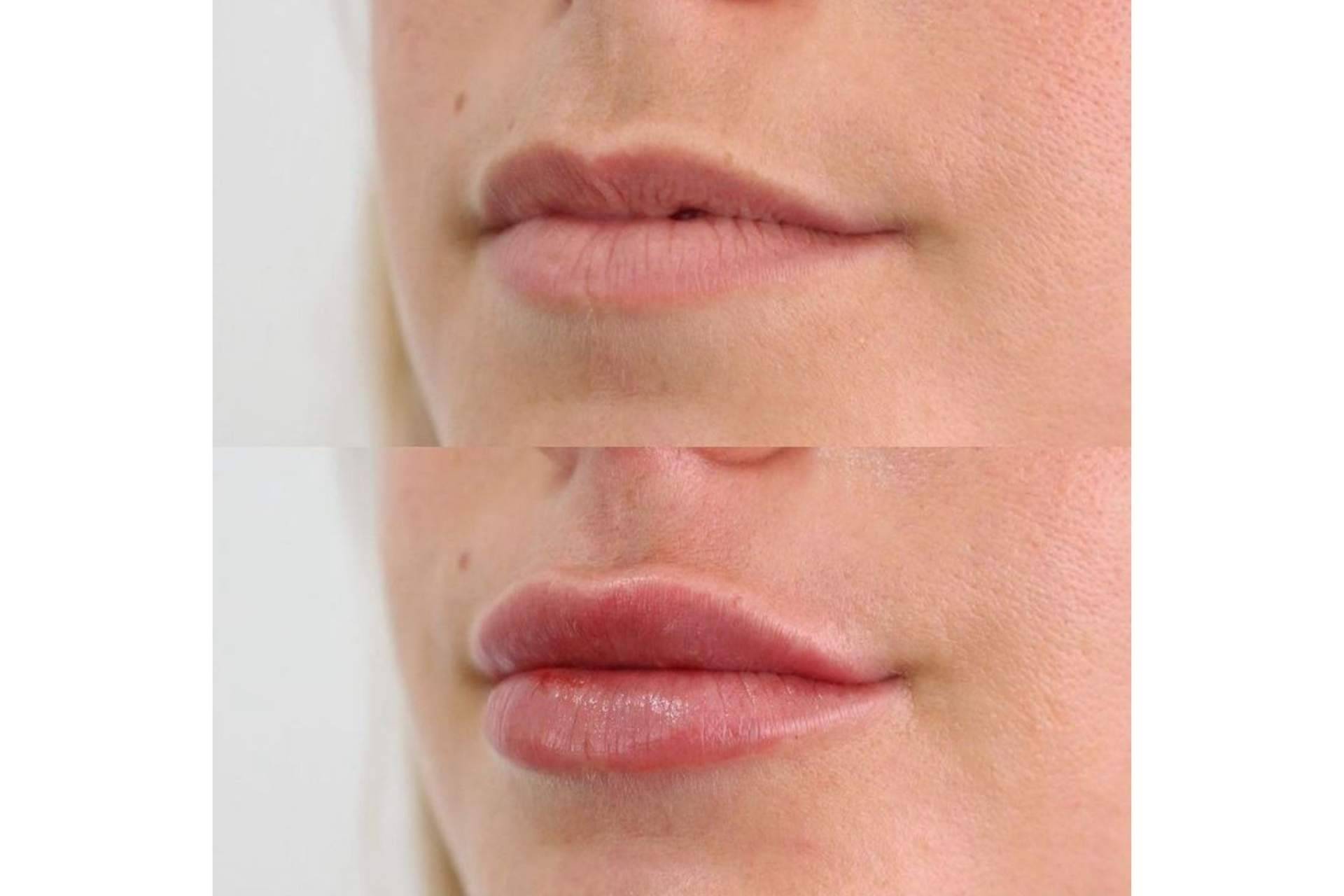 El doctor Castellar ofrece tratamientos estéticos con los que se consigue revitalizar la expresión facial de mujeres y hombres